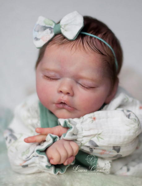 Preorden el kit Miracle - Lorraine Yophi product foto